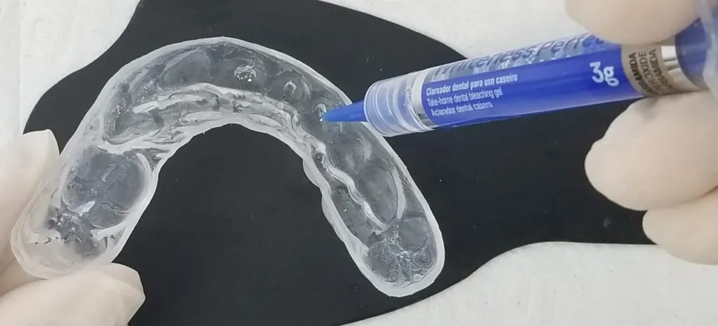 30661 teeth whitening results