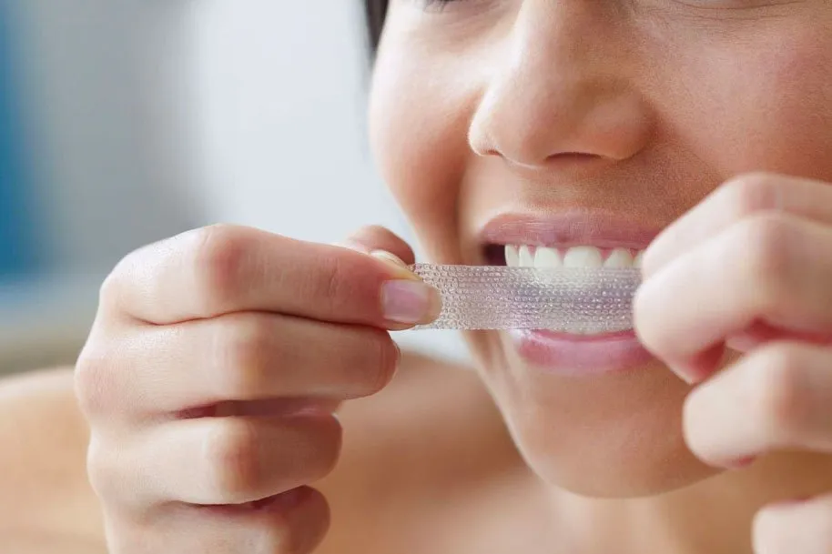 30665 expired teeth whitening strips