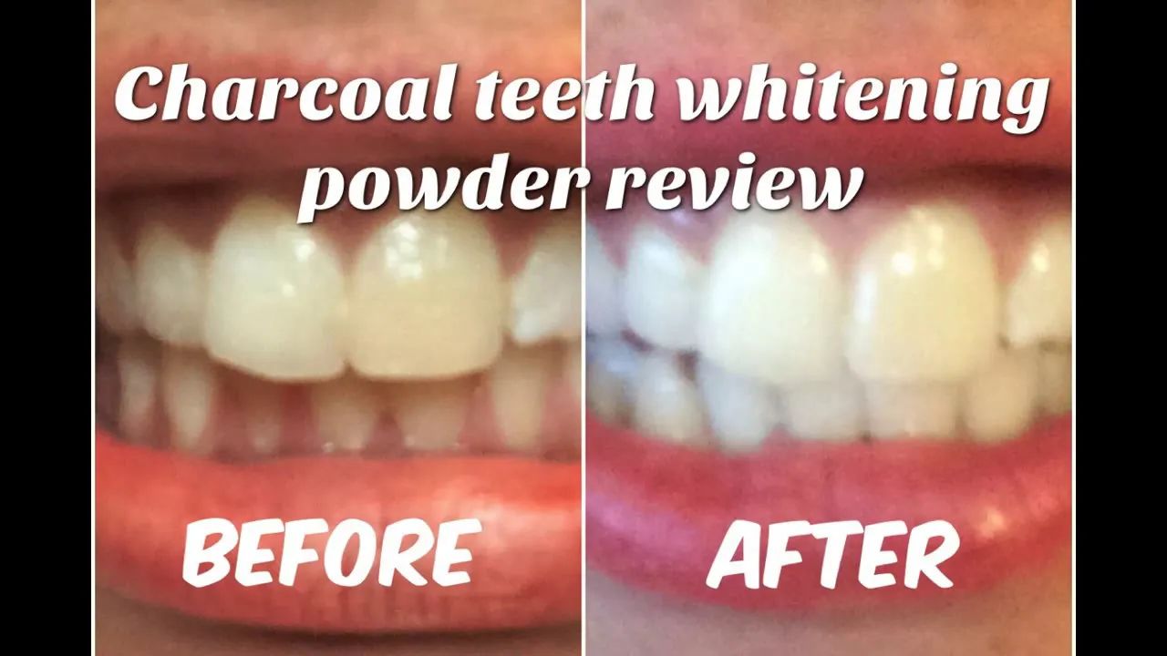 30679 teeth whitening brushing technique