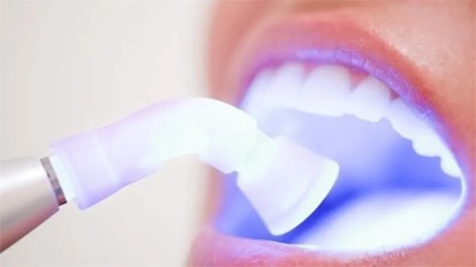 30682 teeth whitening cost