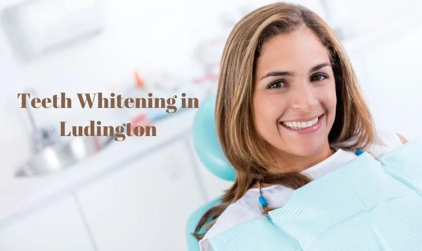 30684 teeth whitening provider michigan
