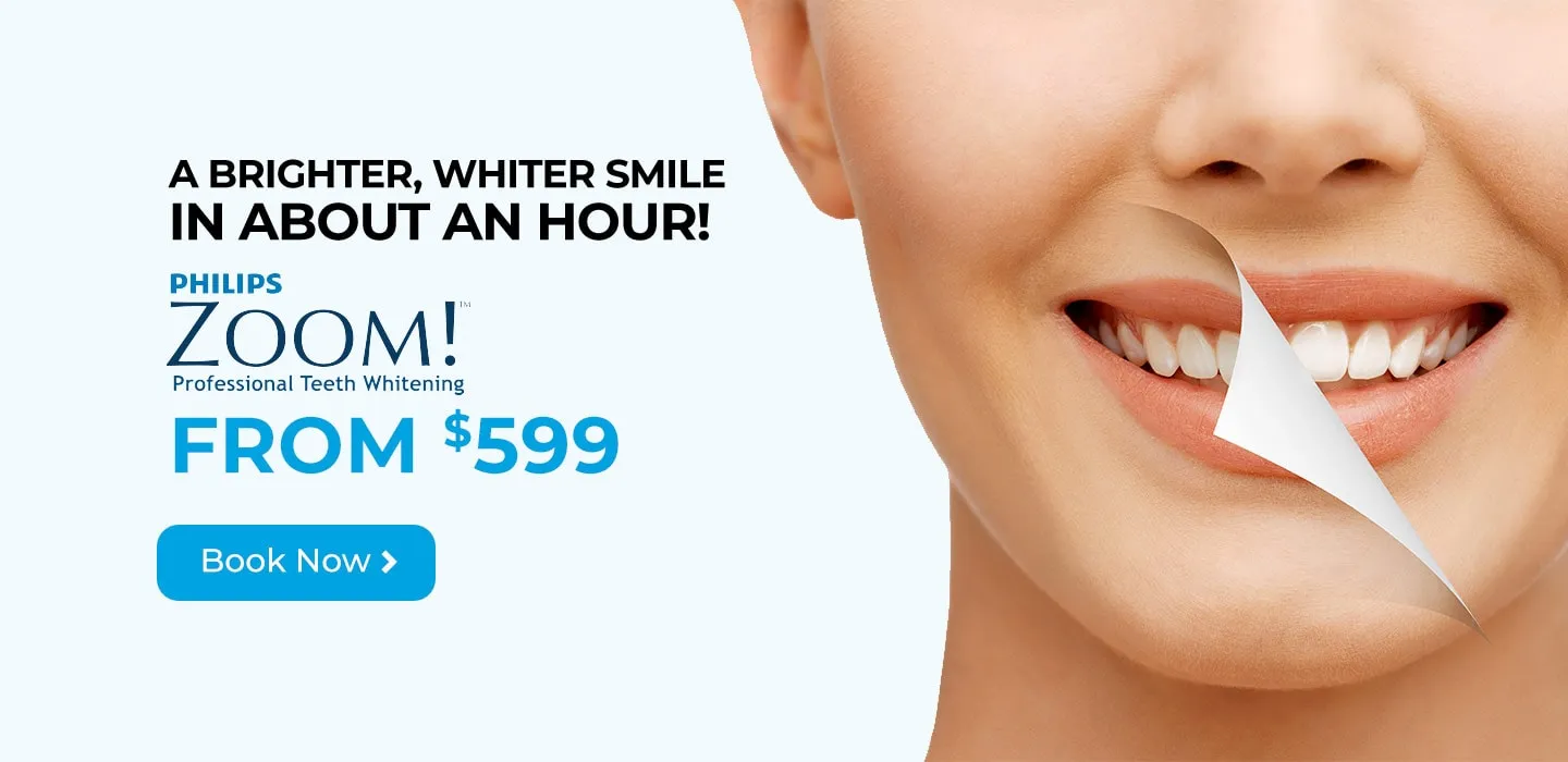 30699 consult dentist teeth whitening