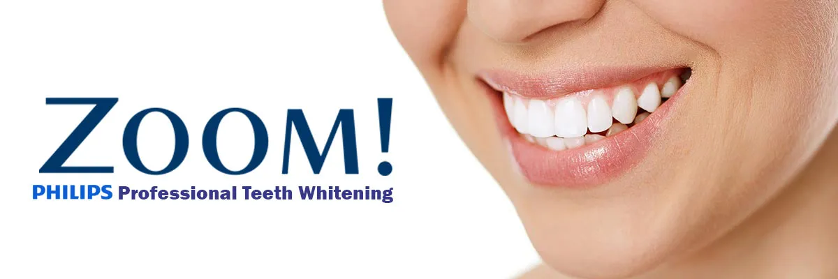 /img/30699-oral-hygiene-teeth-whitening.webp