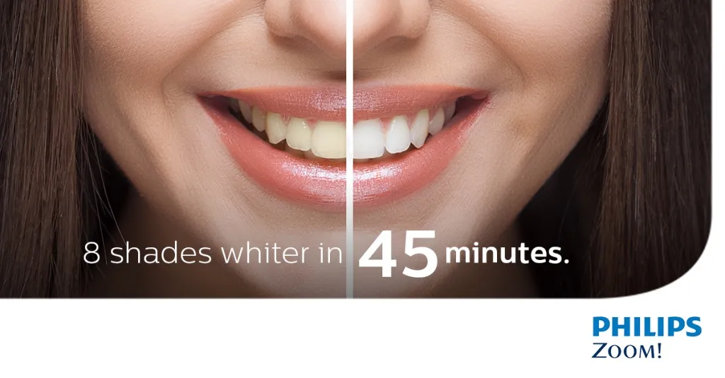 30699 professional teeth whitening