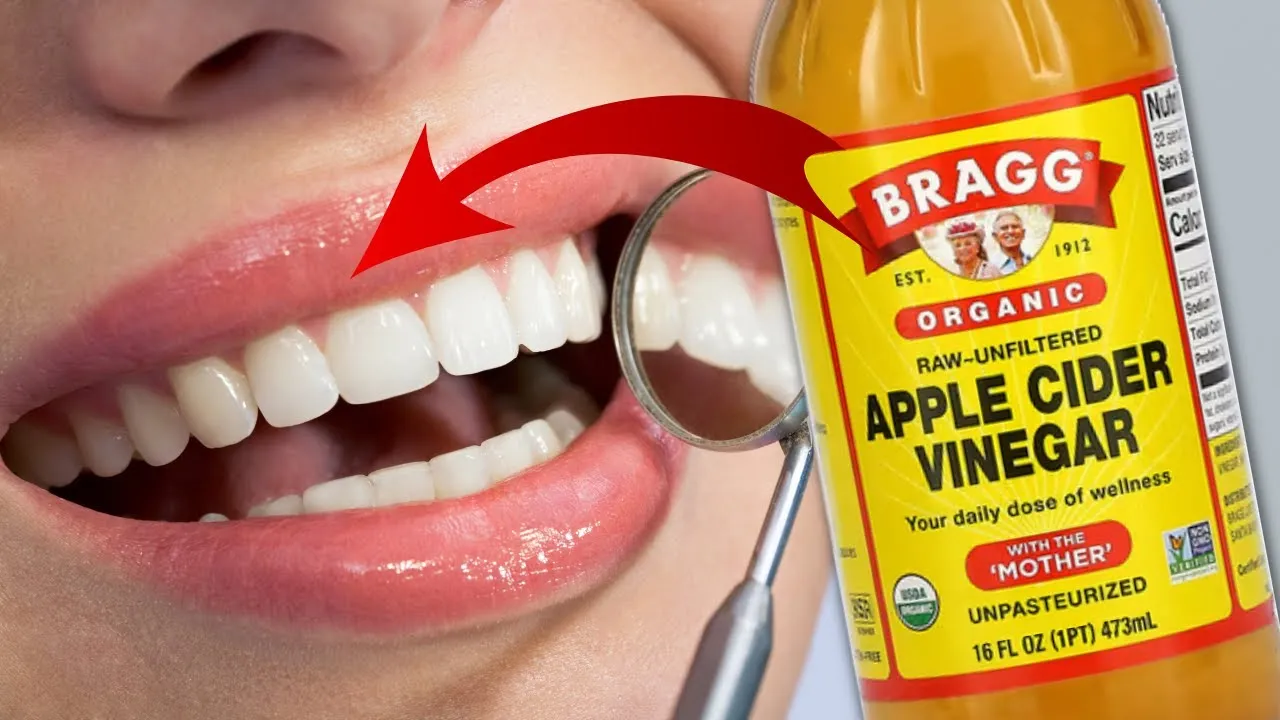 30717 acv teeth whitening image4