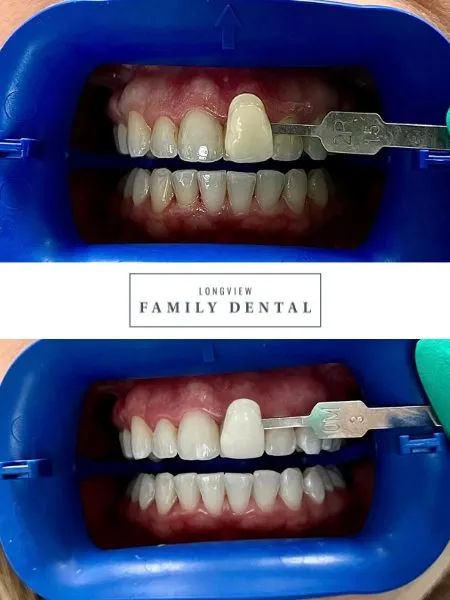 30722 staining foods and drinks