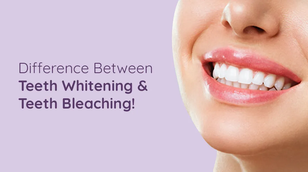 30728 teeth whitening pros