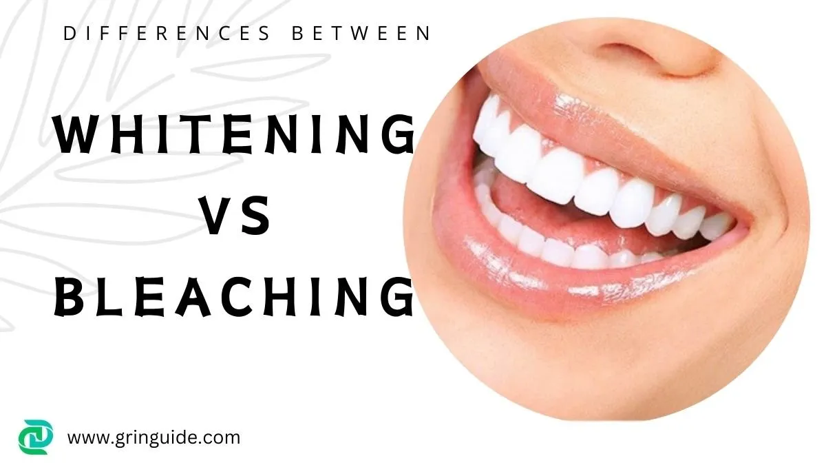 30728 teeth whitening vs bleaching overview