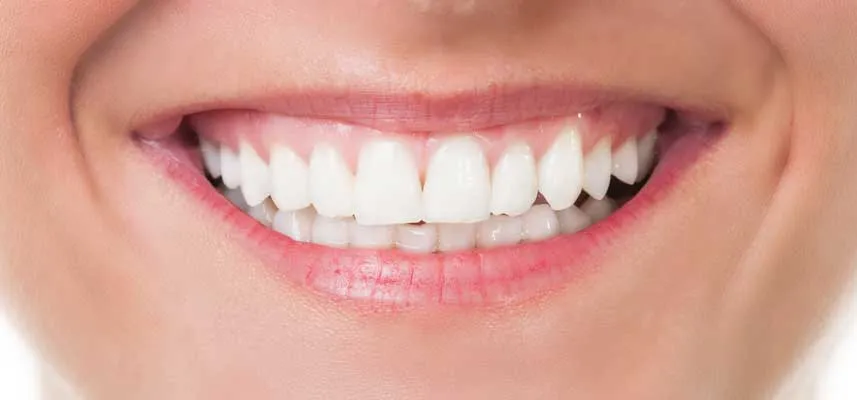 30729 maintaining white smile tyler tx