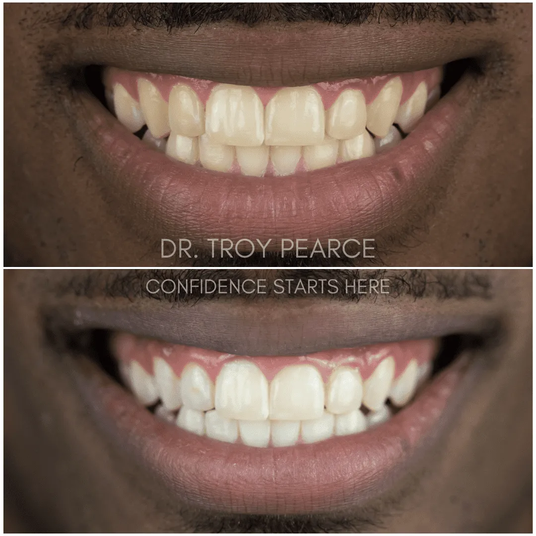 30731 dental hygiene cincinnati