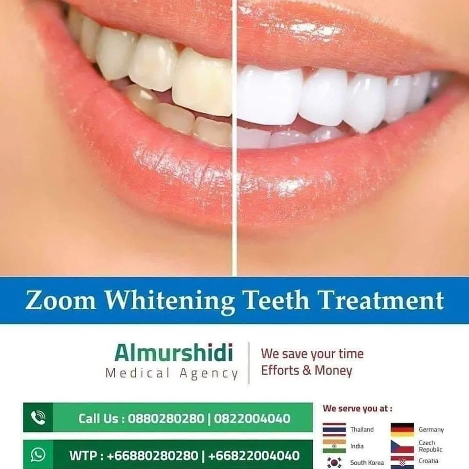 30750 teeth whitening procedures thailand
