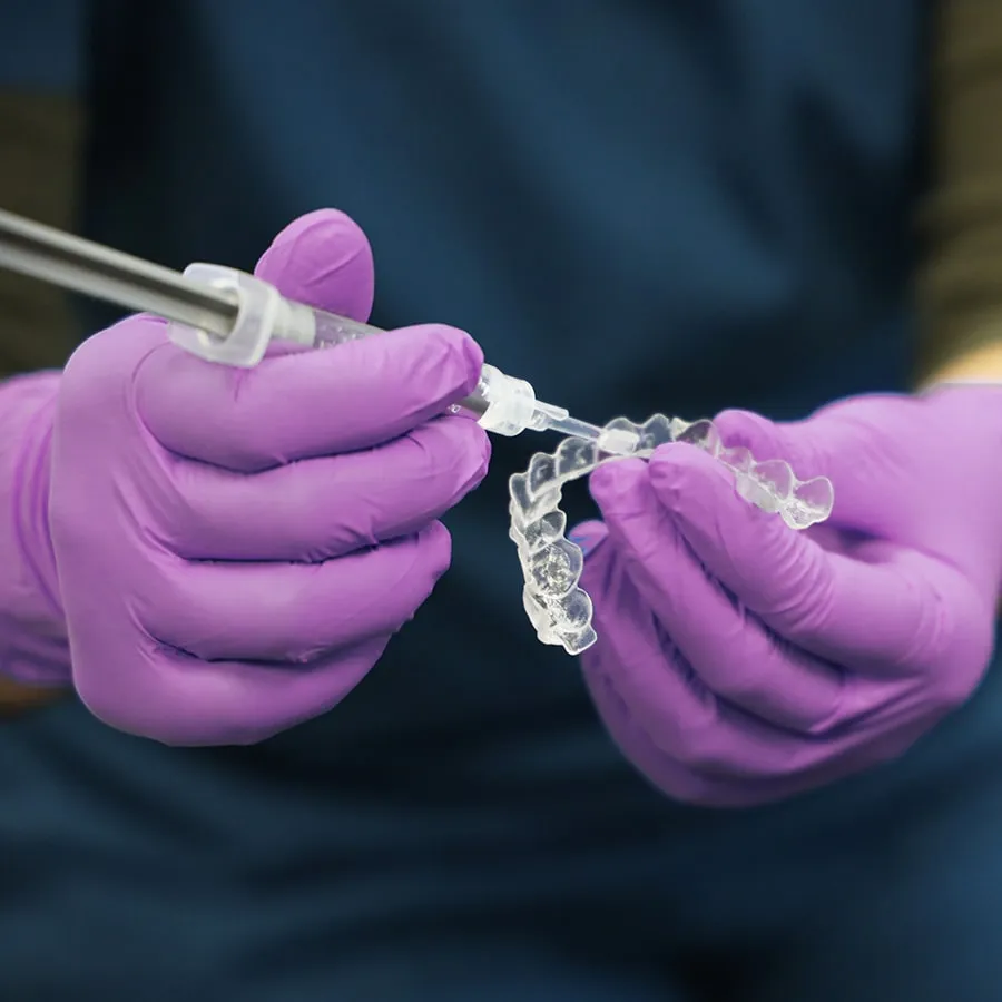 30759 salisbury teeth whitening before after