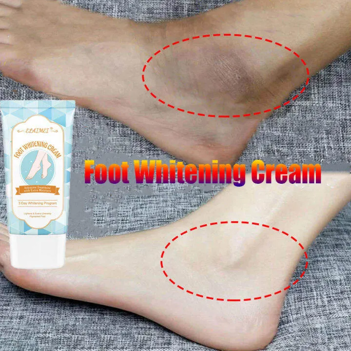 30764 feet whitening cream application