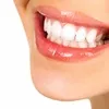 /img/30767-teeth-whitening-brighton-patient-consultation.webp