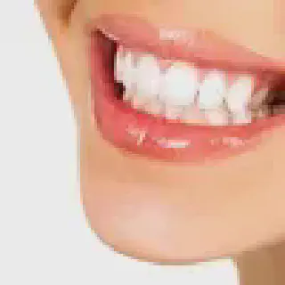/img/30767-teeth-whitening-brighton-patient-consultation.webp