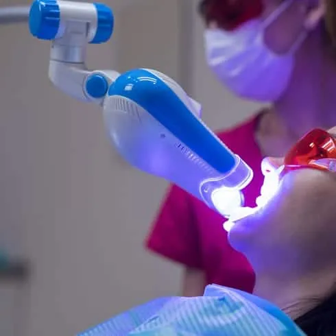 30780 in office teeth whitening