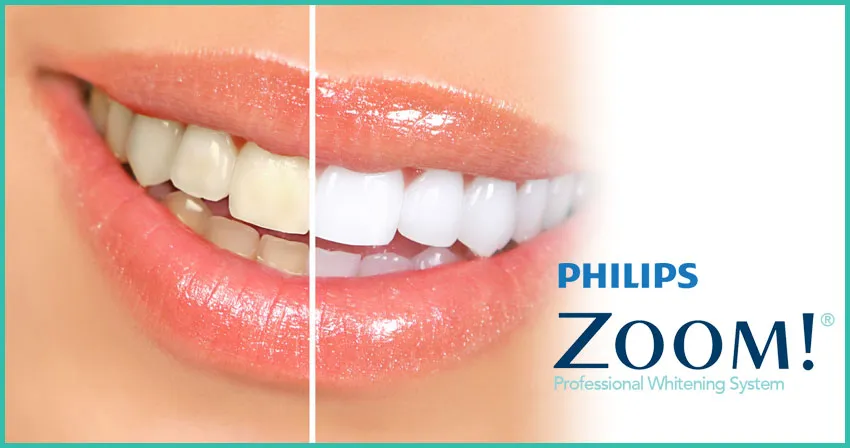 /img/30785-zoom-teeth-whitening-atlanta-7.webp