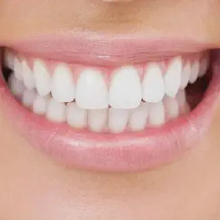 /img/30786-choosing-dentist-teeth-whitening-alexandria.webp