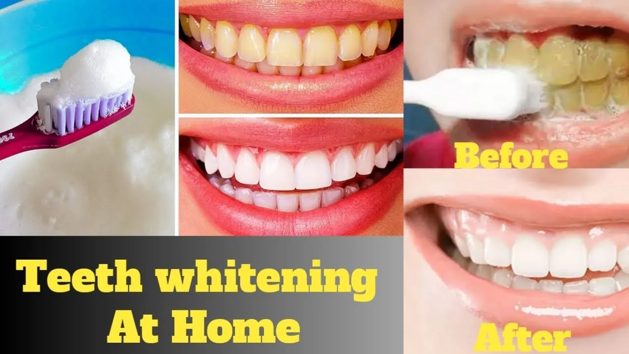 30801 whitening dentist