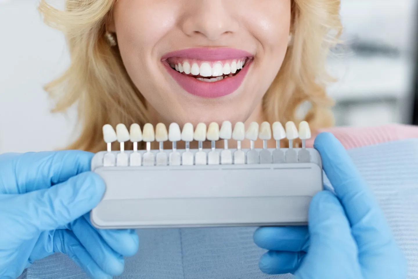 30809 professional teeth whitening