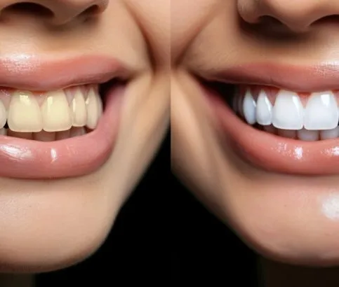 30809 teeth whitening toothpaste