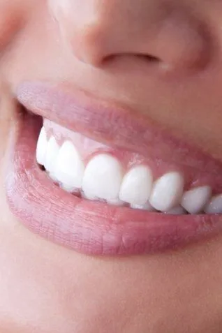 30815 oral hygiene routine