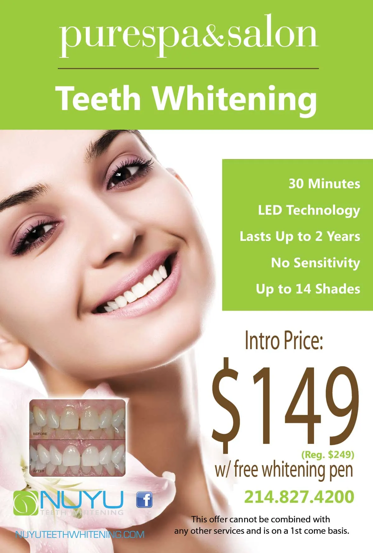 30815 teeth whitening aftercare
