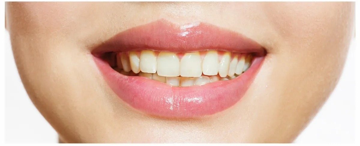 /img/30822-burnaby-dentist-teeth-whitening.webp