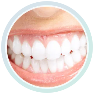 30822 teeth whitening burnaby cost