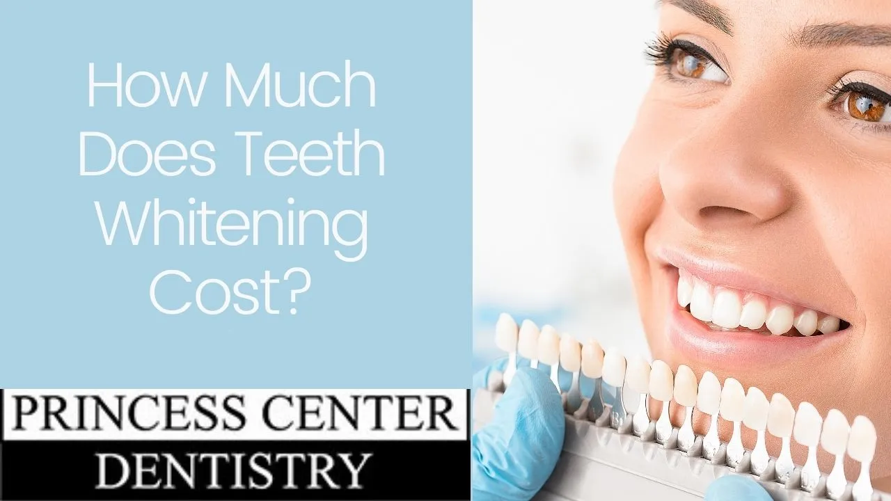 30823 teeth whitening comparison