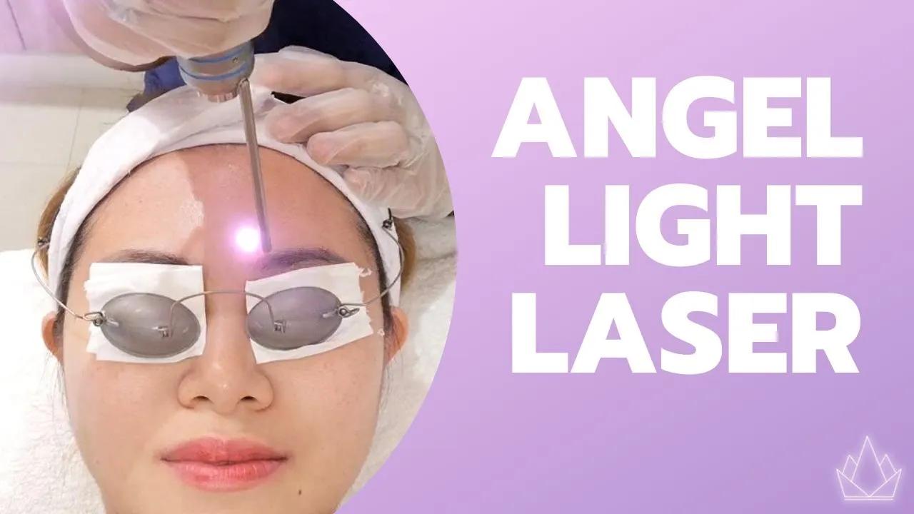 30848 angel whitening laser teeth