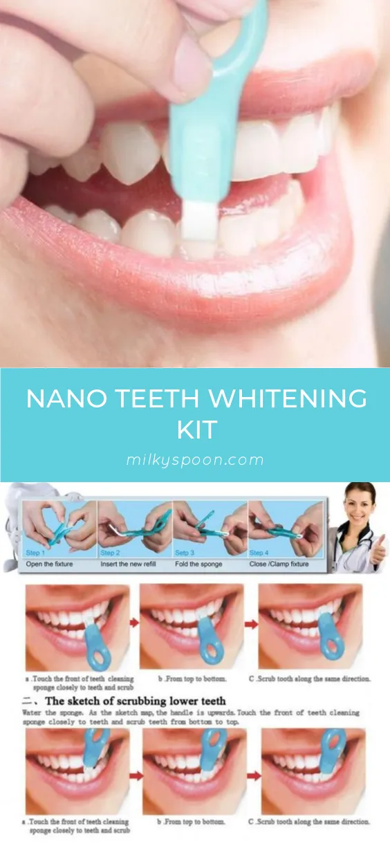 30850 before and after teeth whitening