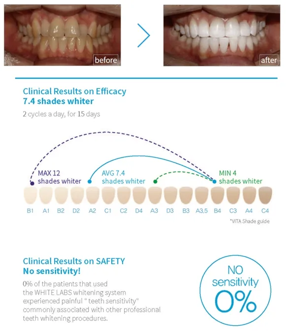 30850 teeth whitening process