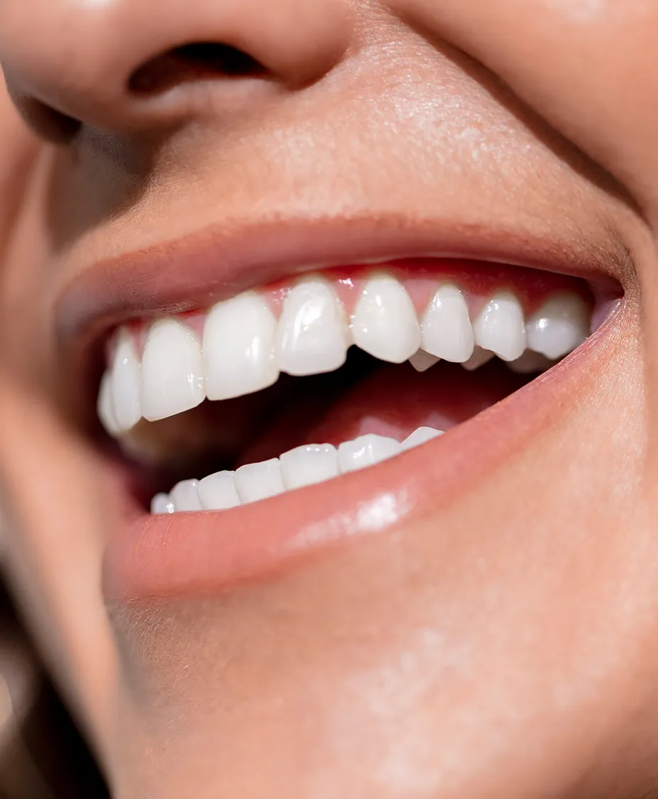 30851 dental cleaning west hollywood