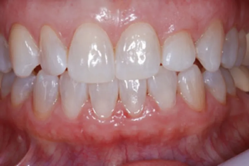 30851 maintaining white smile