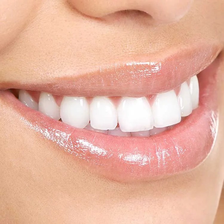 30851 teeth whitening options