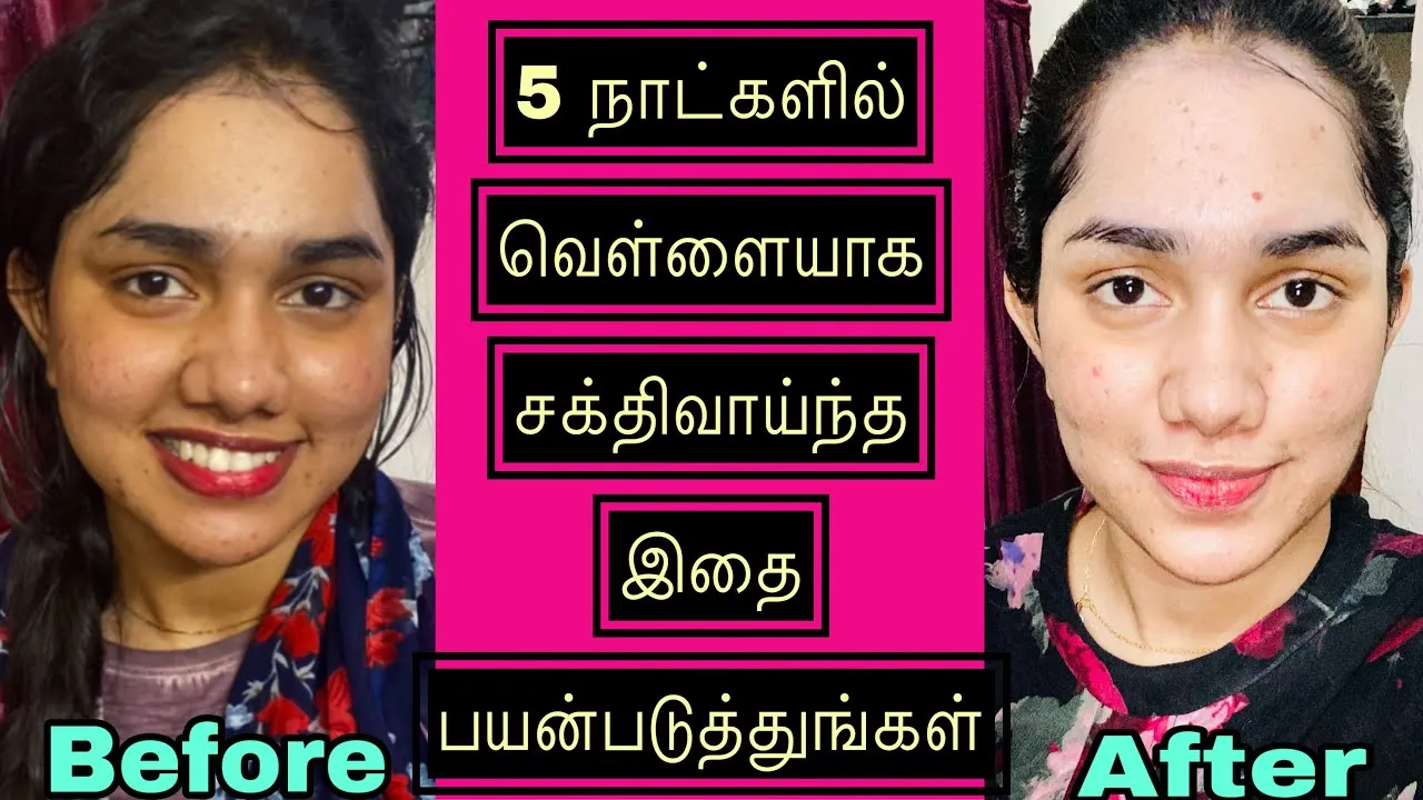 30853 chemical peels for skin