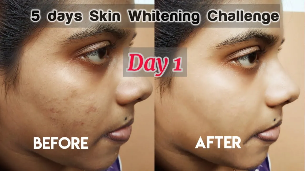 30853 skin discoloration causes