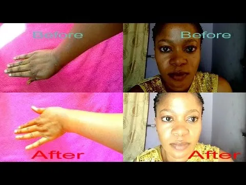 30853 sun damage skin