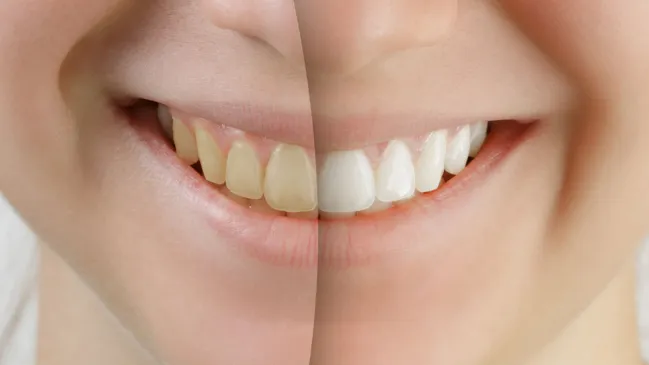 30859 confident smile