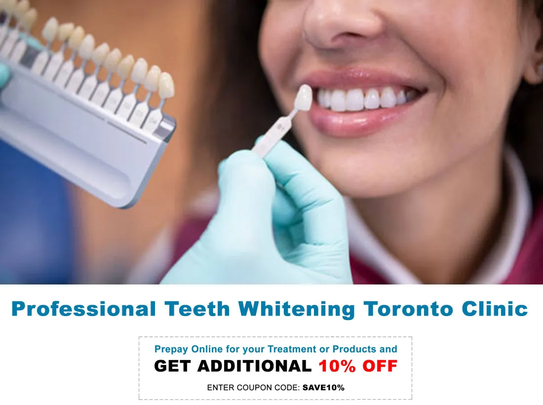 30859 take home whitening