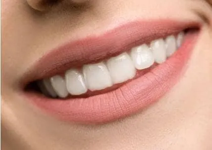 /img/30872-teeth-whitening-mornington-peninsula-clinic.webp