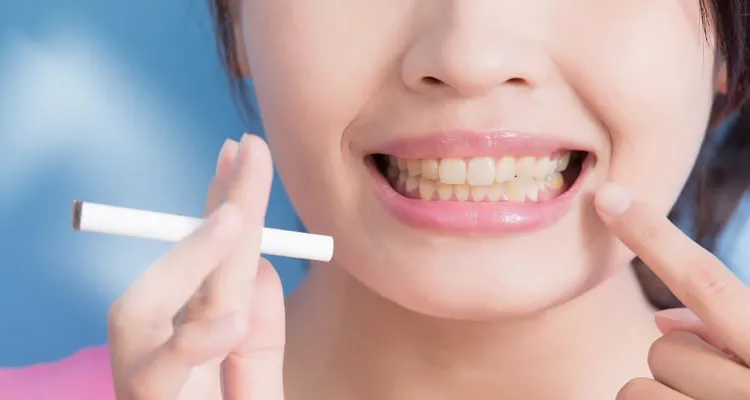 30876 in office teeth whitening