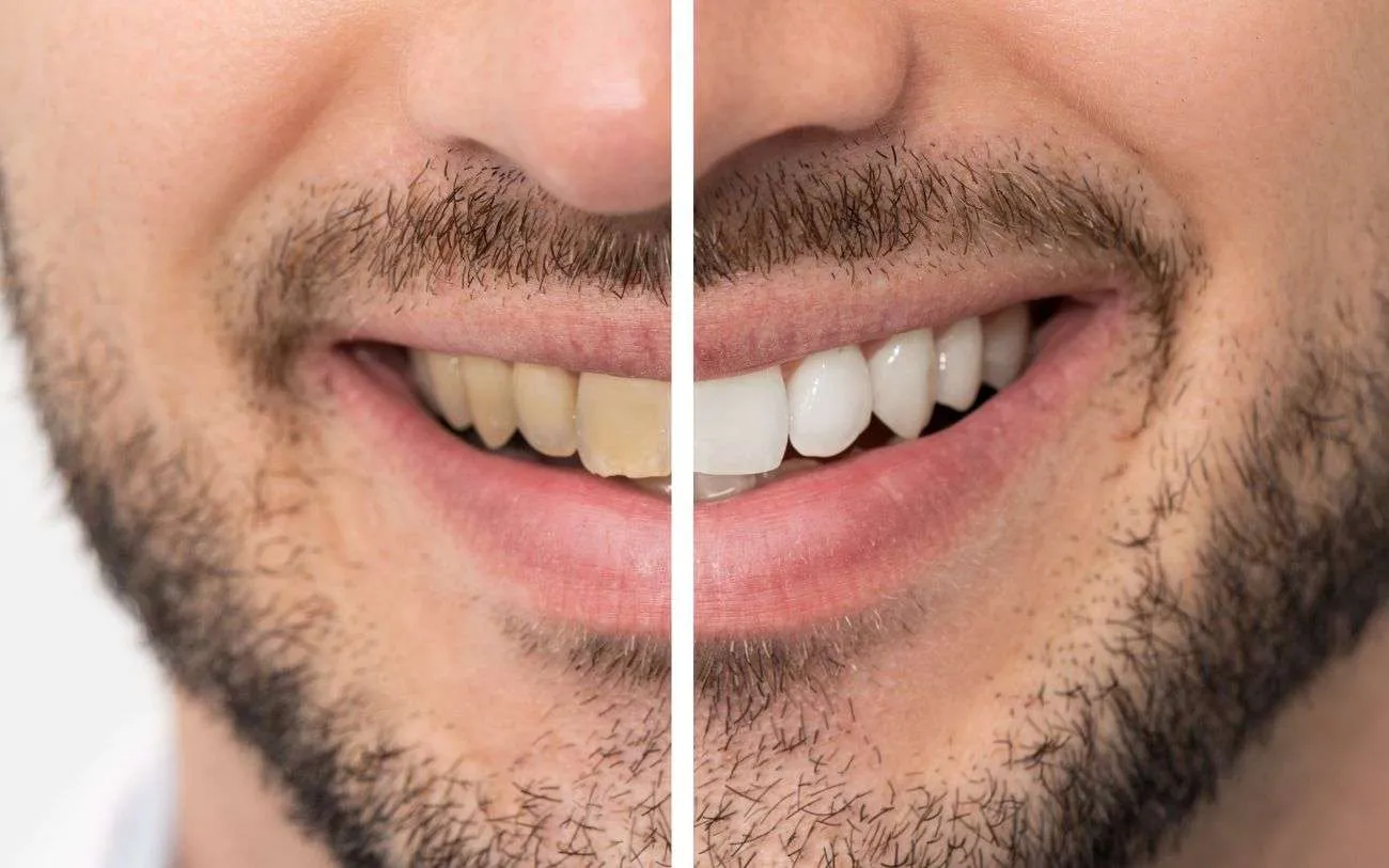 30876 quitting smoking benefits