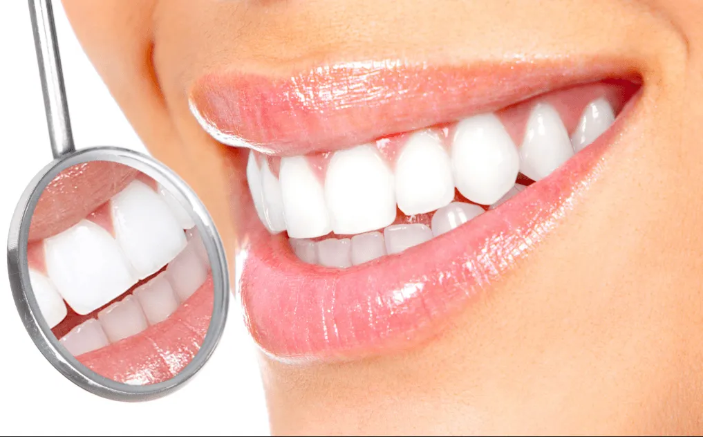 30879 teeth whitening diet