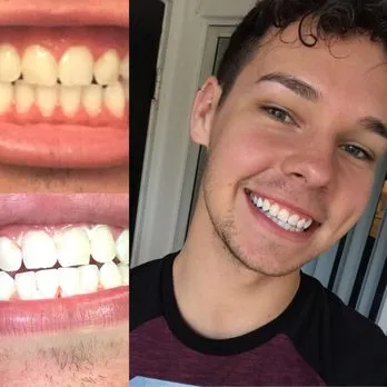 30884 dental hygiene tips