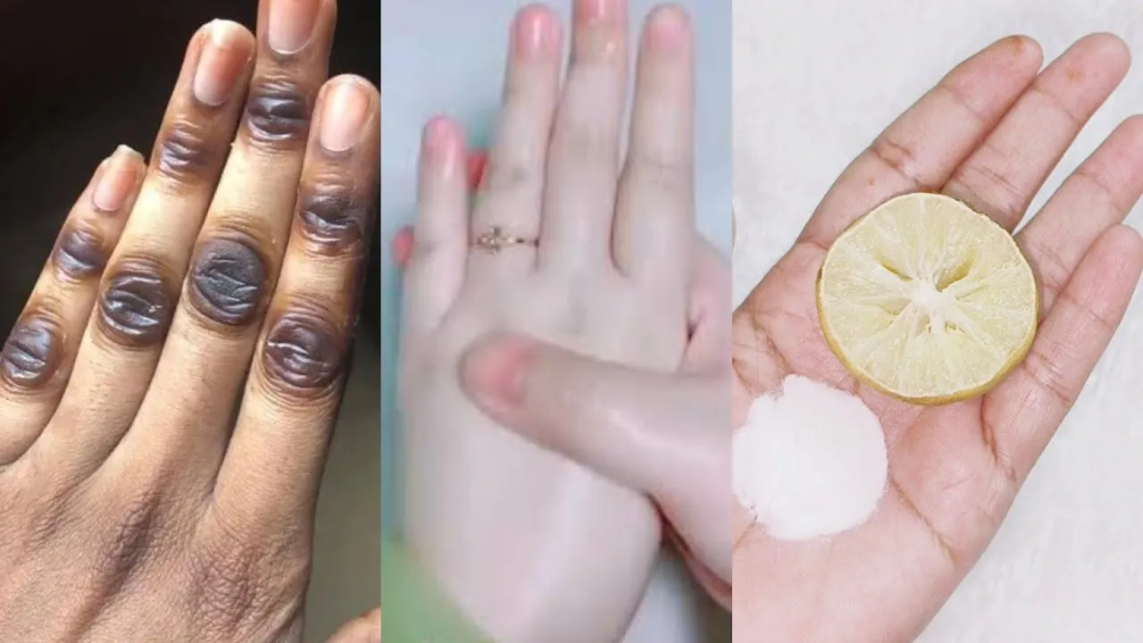 30888 baking soda exfoliation