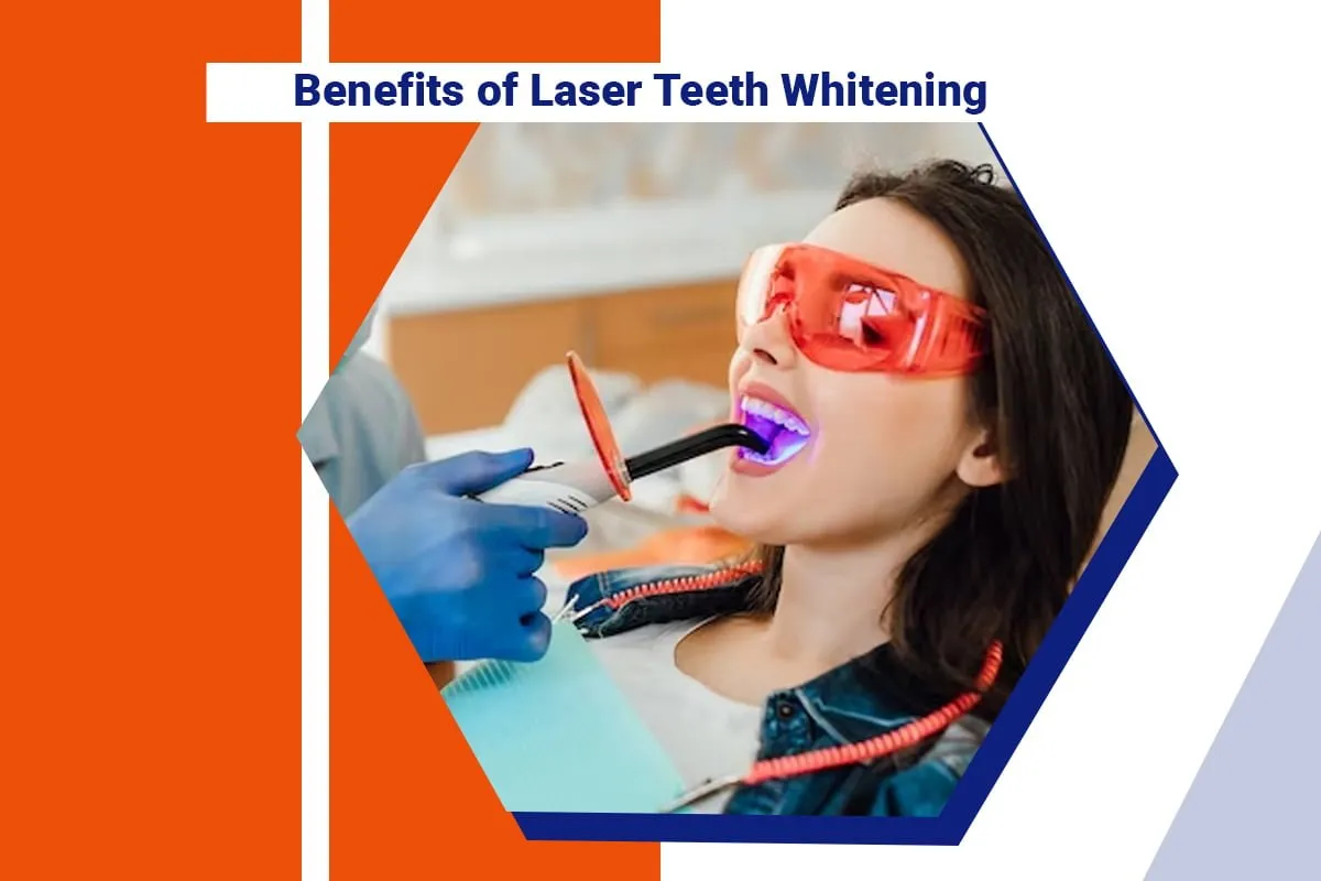 30889 laser teeth whitening maintenance