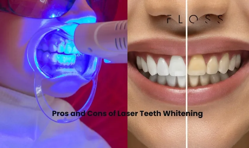 30889 laser teeth whitening sensitivity