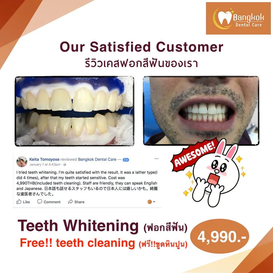 30897 oral hygiene bangkok